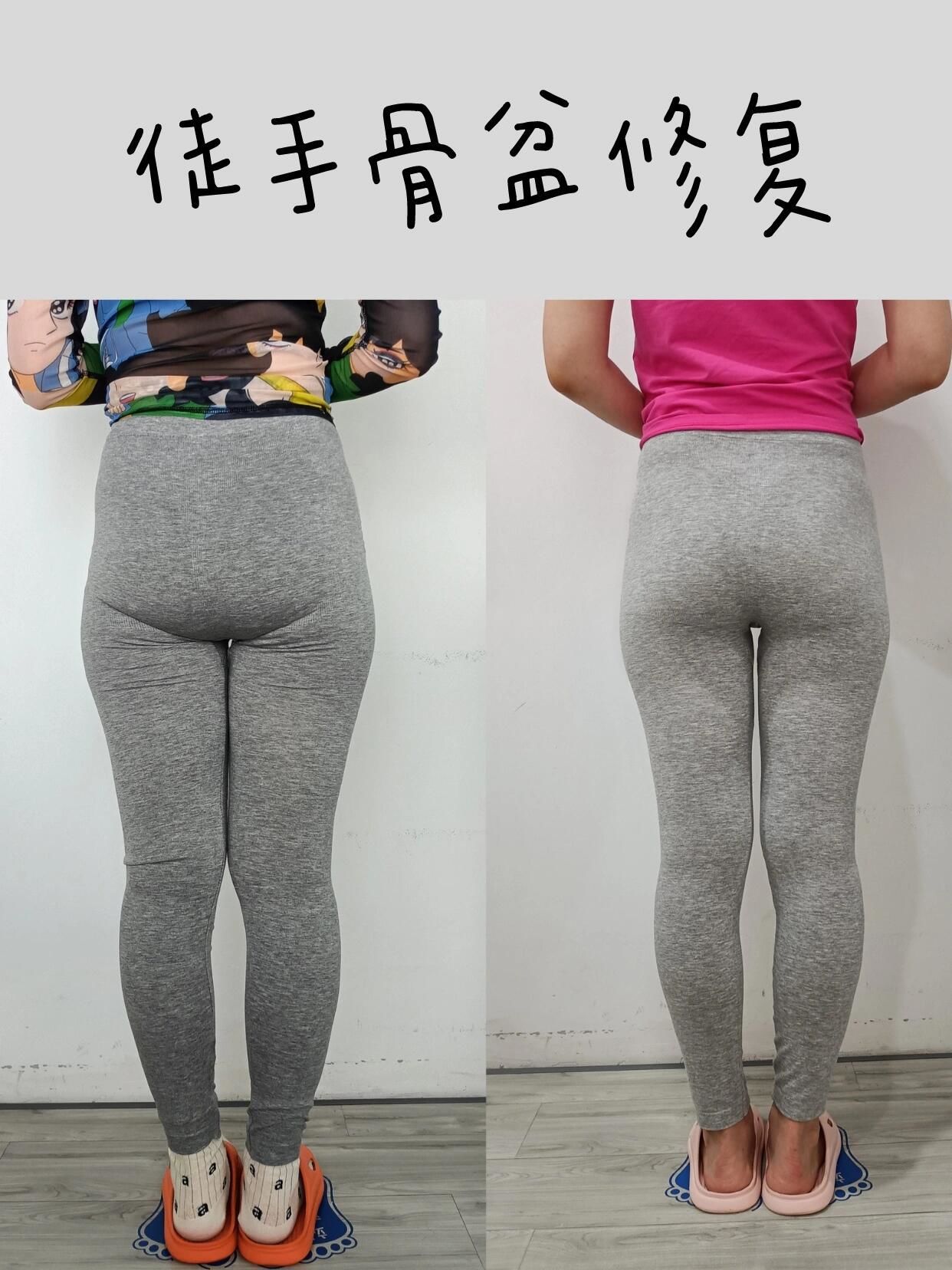 修复前